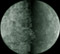 Mercury composite